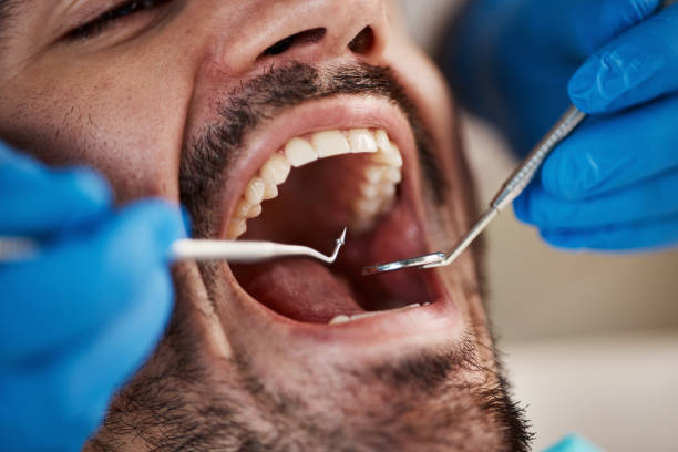 Best Tooth Infection Emergency Dentist  in Hernando, FL